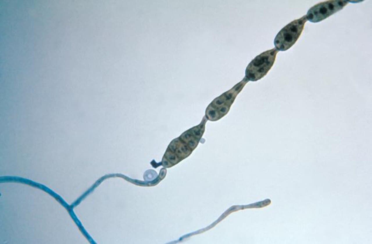 Alternaria (Alternaria alternata m.fl.) — Mögelsporer i luften — mikroskopiskt små, mörka konidier som bildar kedjor. Vanligast utomhus efter regn och vid torrt, varmt väder; syns inte med blotta ögat.